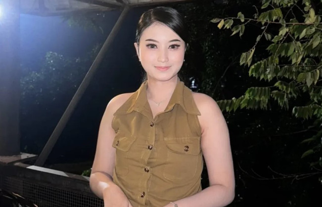 Penyanyi dangdut dan aktor FTV Cantika Davinca alami kecelakaan di Magetan, pada Jumat (3/10/2025). (Instagram)
